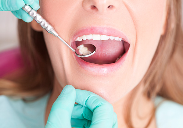 services, implants - mirror in woman's mouth